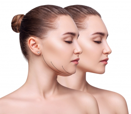 Как подтянуть шею и подбородок: операция и методы косметологии — Институт  Пластической Хирургии на Трубной