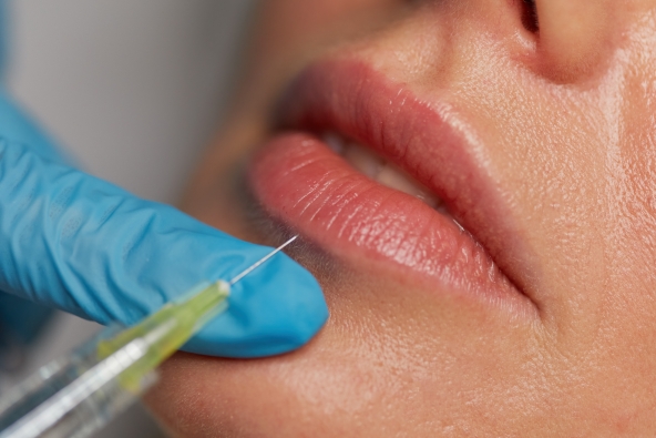 Отек, синяки, комки после увеличения губ, что можно и нельзя делать после  увеличения губ — Институт Пластической Хирургии на Трубной