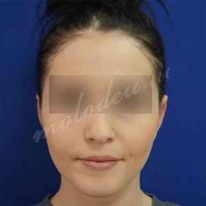 Гуляев_отопластика_23.03.21