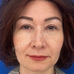 ��������_�����