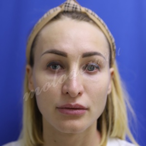 ��������_�����