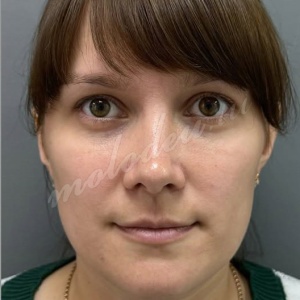 ����_�����