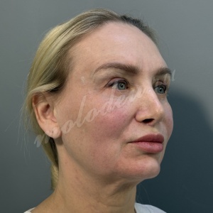 ����_��������