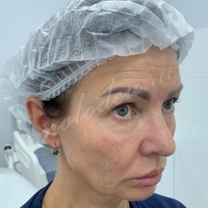 �������������� �������