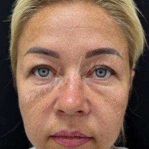 �������_���������