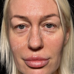 �������_��������