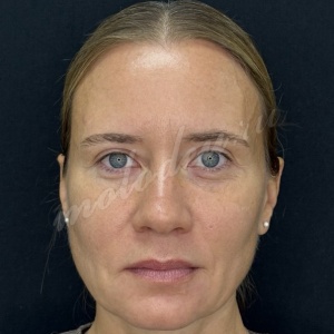 Верхняя_Гусев