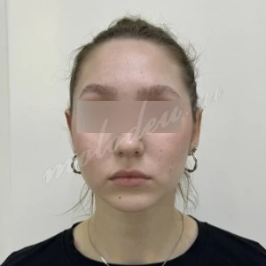Отопластика _Делецкий