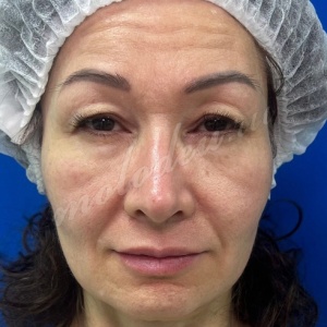 ��������_�����