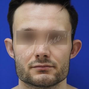Пирмагомедов_отопластика_05.05