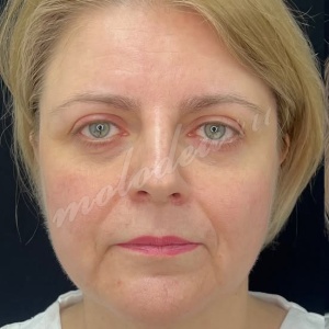 СМАС +платизма_Гусев