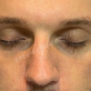_
