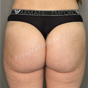 _ 