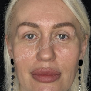 �������_��������