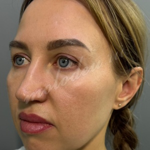 Комплекс_Гуляев