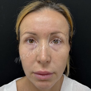 �����-�������� �������_����������