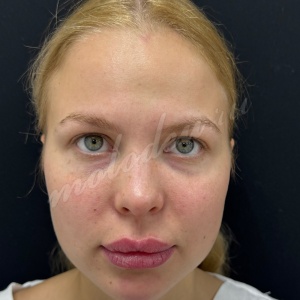 Комплекс_Гуляев