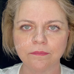 СМАС +платизма_Гусев