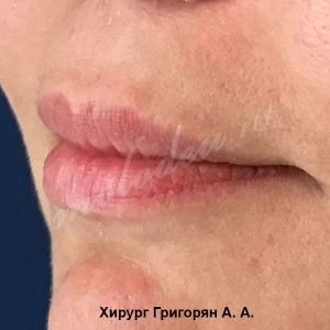 Булхорн Григорян